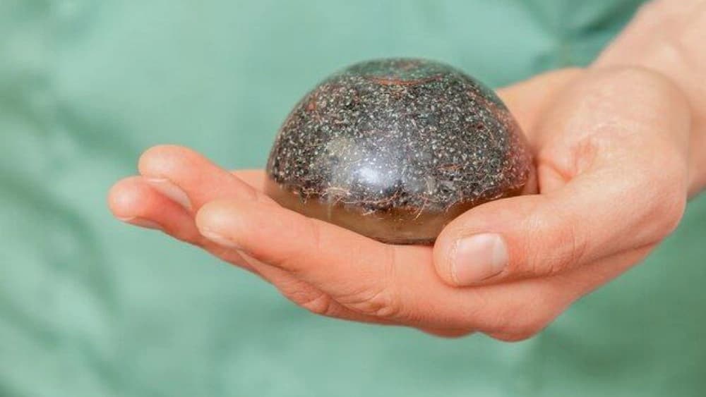 روش‌های سنگ‌درمانی
